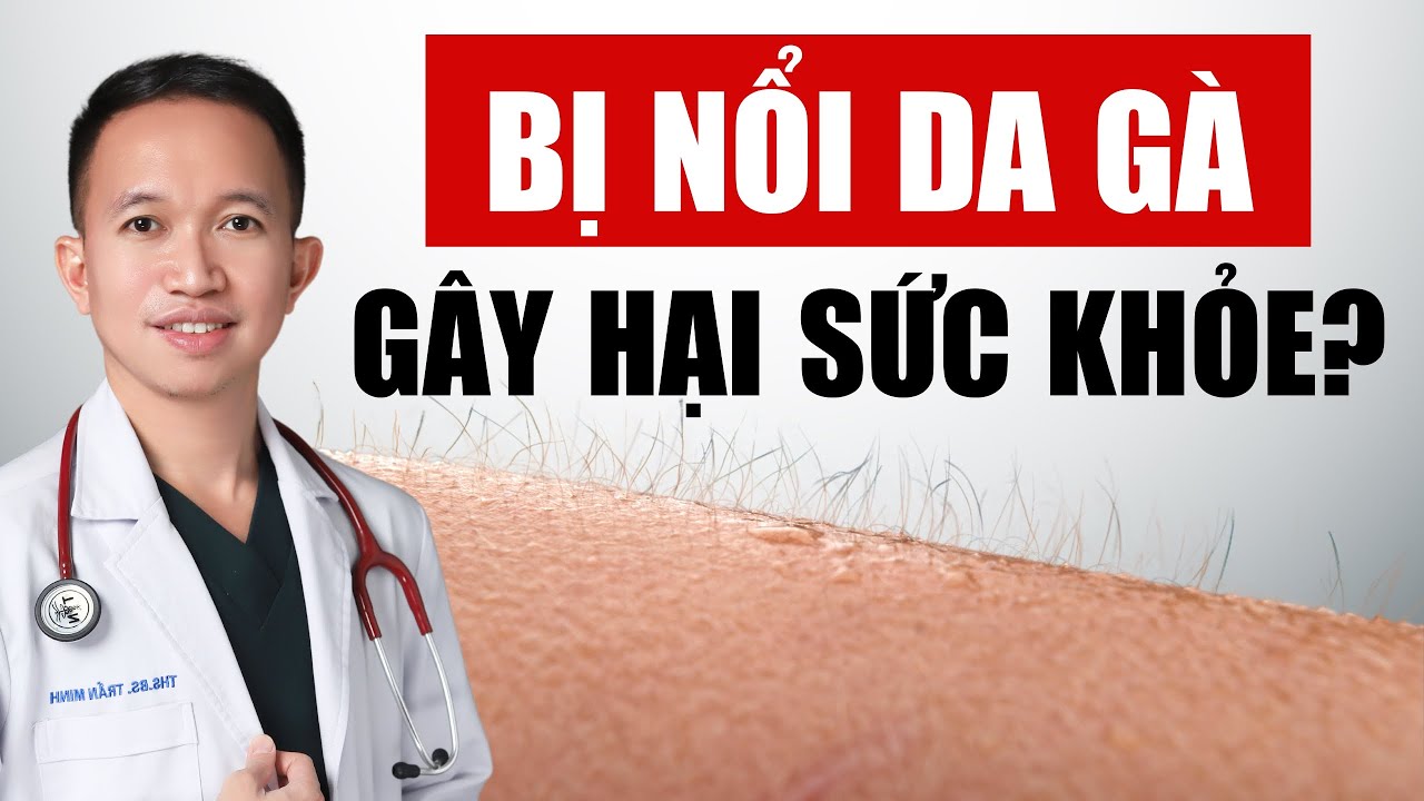 Nổi da g&agrave; c&oacute; ảnh hưởng đến sức khỏe kh&ocirc;ng? | B&aacute;c Sĩ Trần Minh