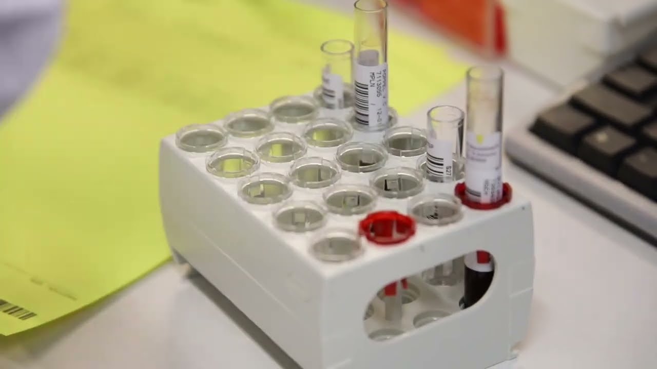 Result Laboratorium   zorgen voor onze klant