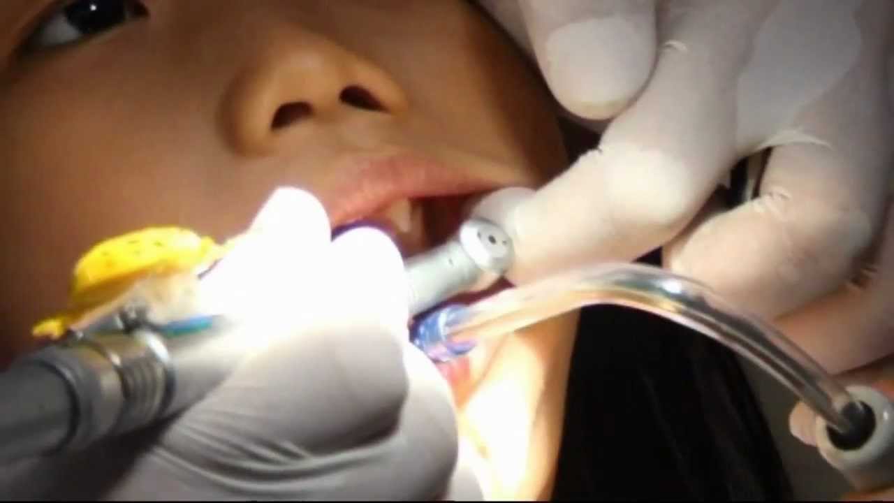 Dentist from Indonesia creates musical drill to help ease patients' fears