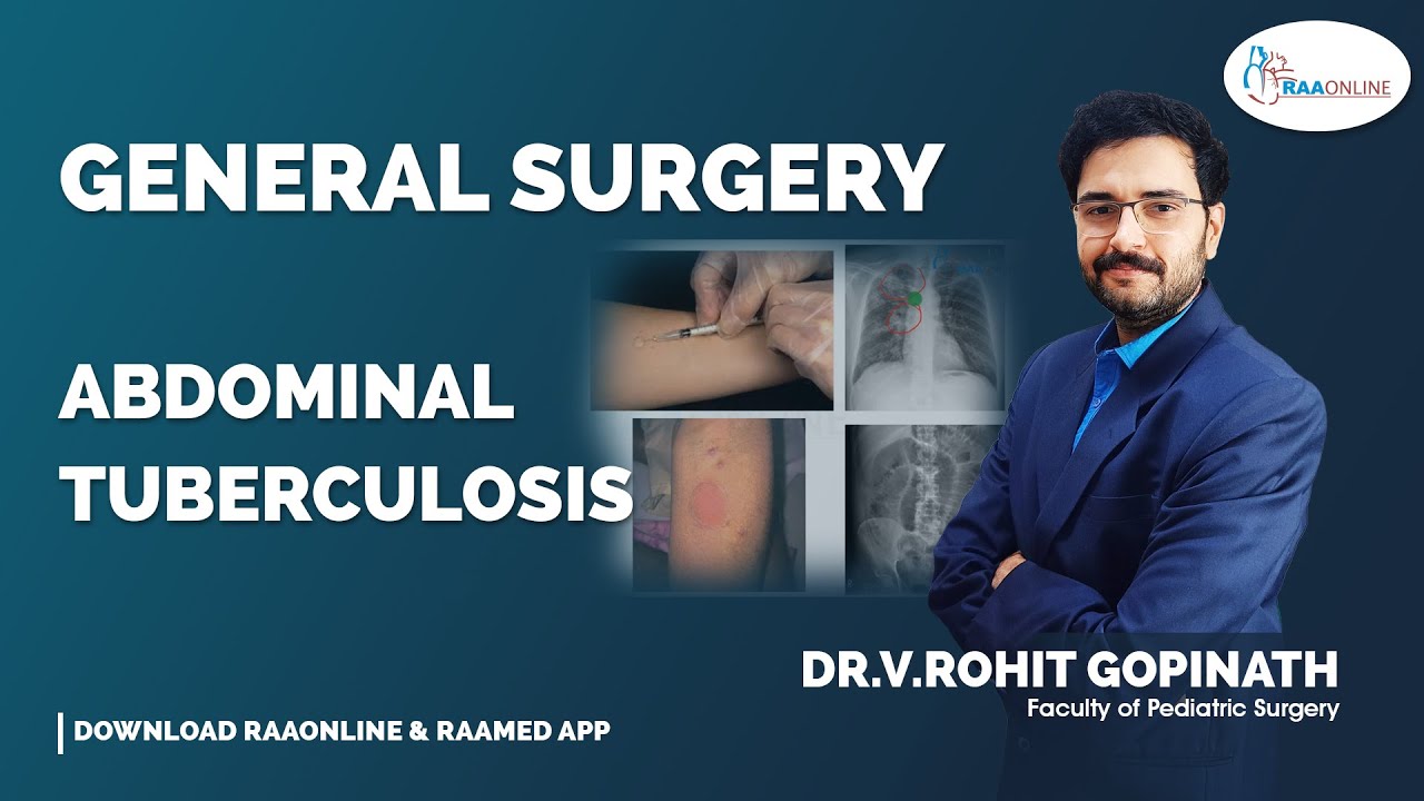 General Surgery | Abdominal Tuberculosis | By Dr.Rohit Gopinath | Raaonline #generalsurgery