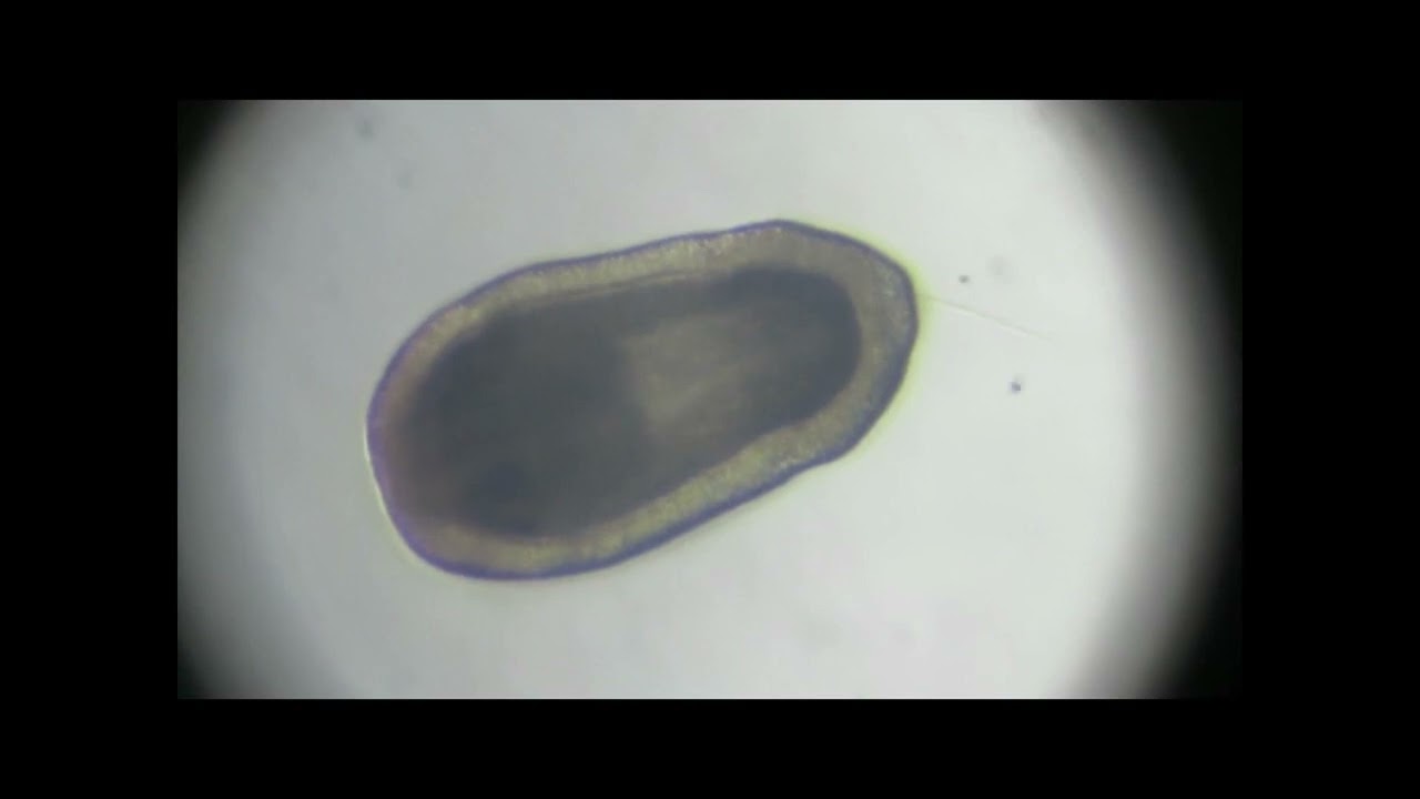 Planula larva from the Adriatic Sea / csal&aacute;noz&oacute; bolyg&oacute;l&aacute;rv&aacute;ja az Adria planktonj&aacute;b&oacute;l.