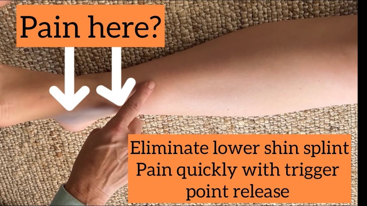Eliminate lower shin splints with trigger point release
