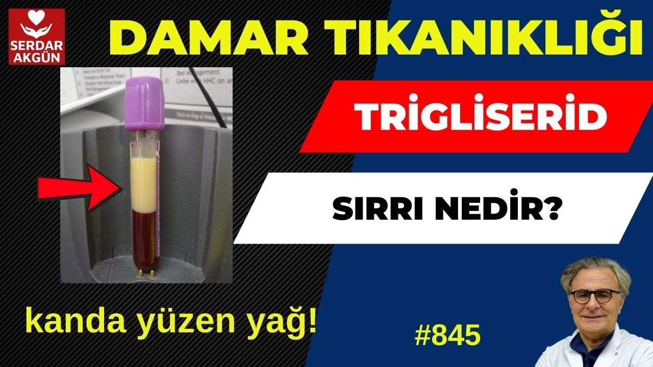 845. Trigliserid nedir? Kanda yağ, Aktüel Sağlık, Prof.Dr.Serdar Akgün, Tıp