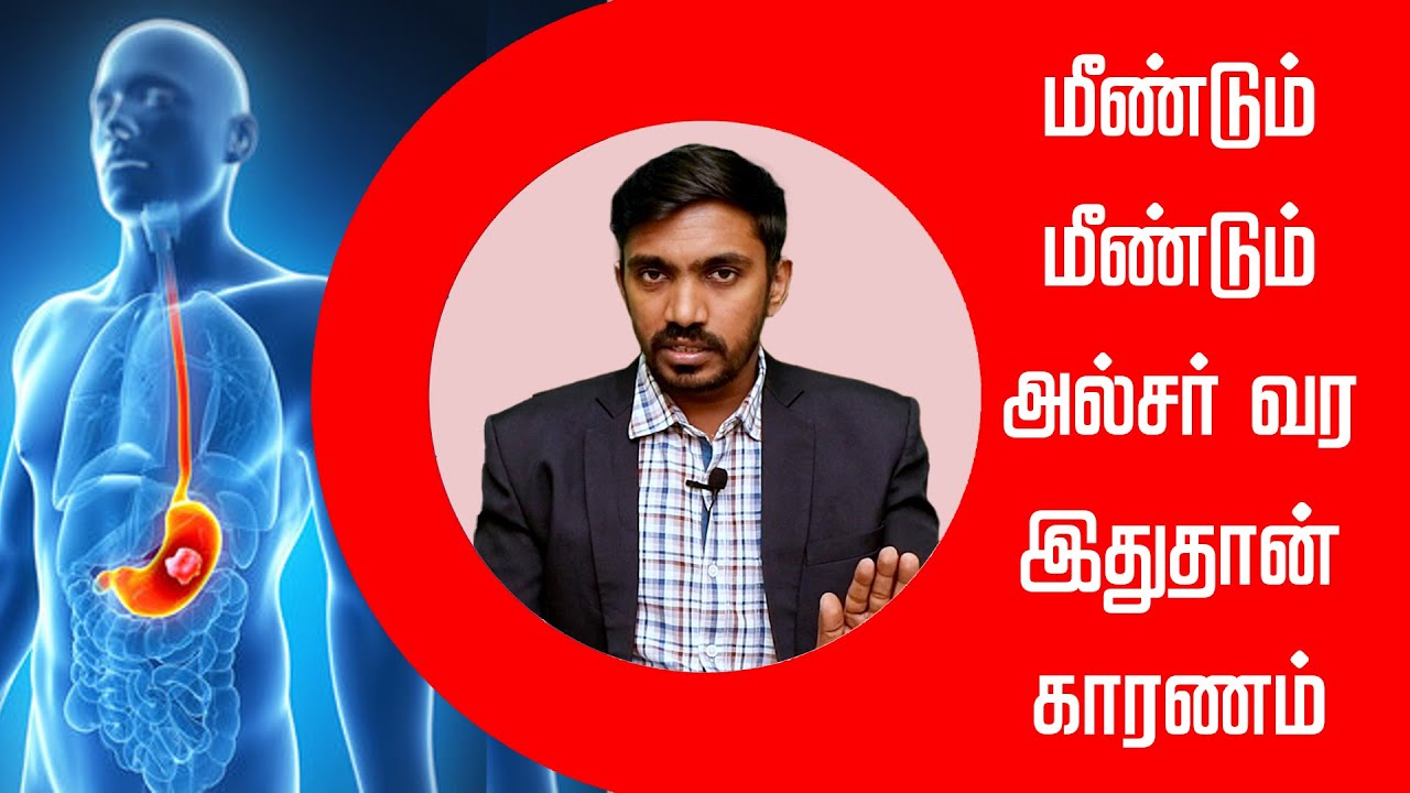 அல்சர் குணமாகாமல் இருப்பதற்கு இது ஒன்றுதான் காரணம் | DrSJ