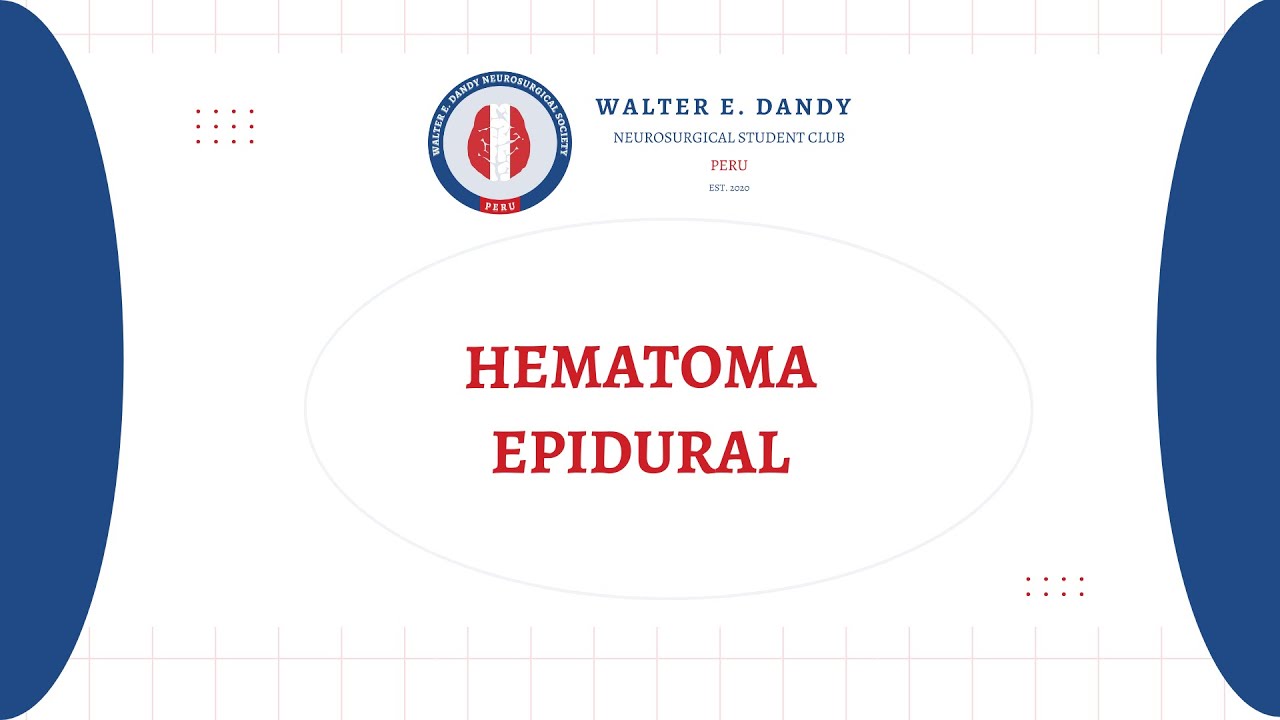 Hematoma epidural