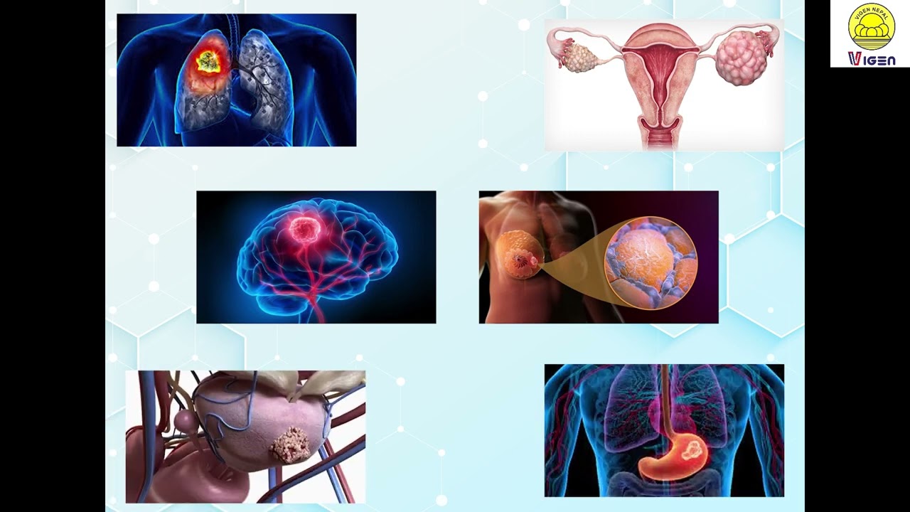 Vigen Nepal korean Thermal Therapy