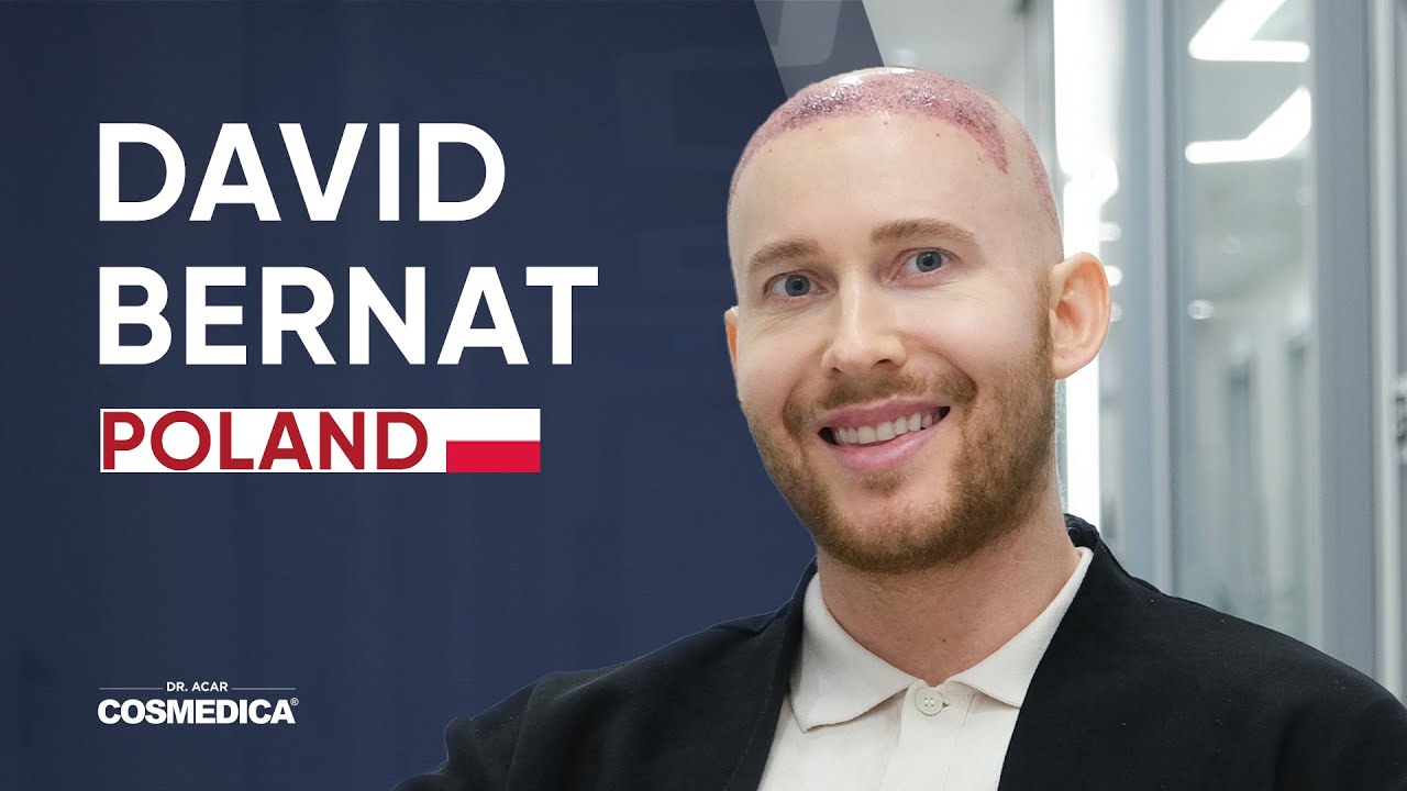 David Bernat Hair Transplant Review | Dr. Acar | Cosmedica Clinic