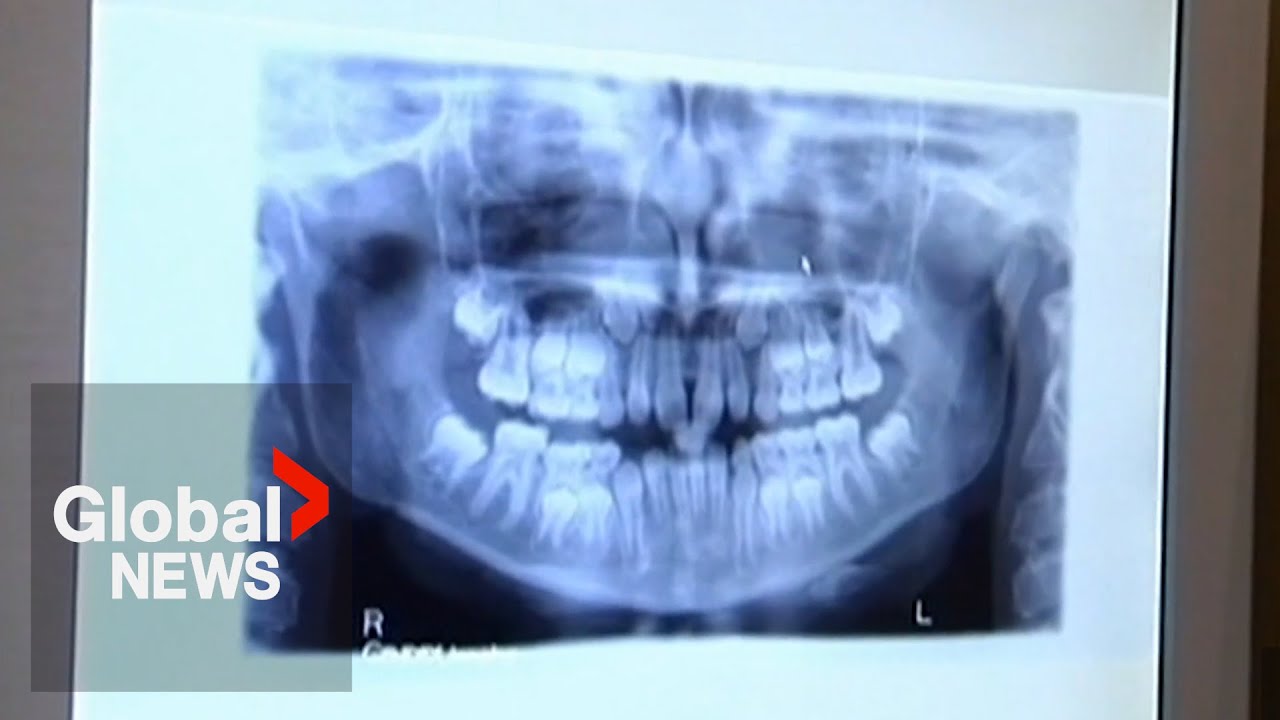 Spike in dental record requests as police work to solve cold cases