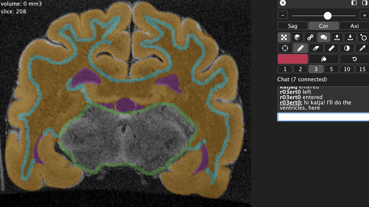 Open Neuroimaging Laboratory