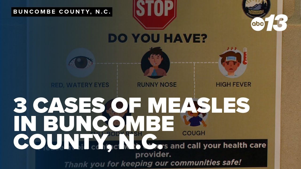 3 cases of measles in Buncombe County, N.C.