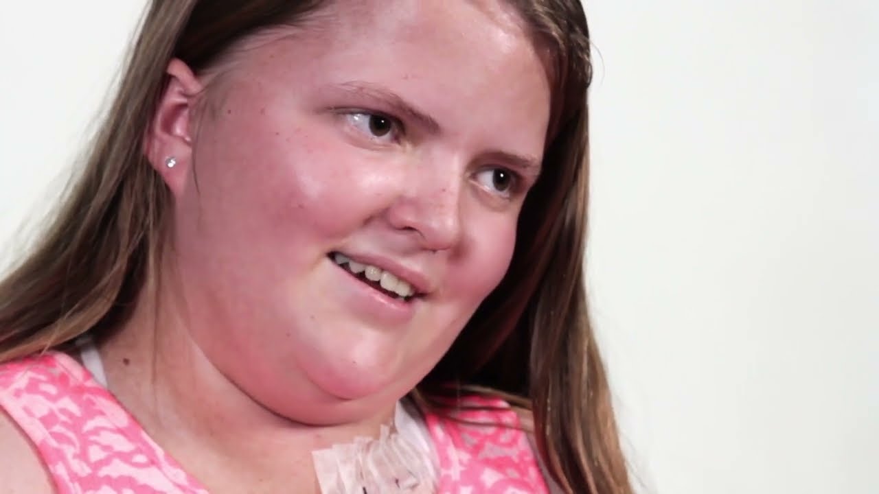 What it's like living with Neurofibromatosis (NF)
