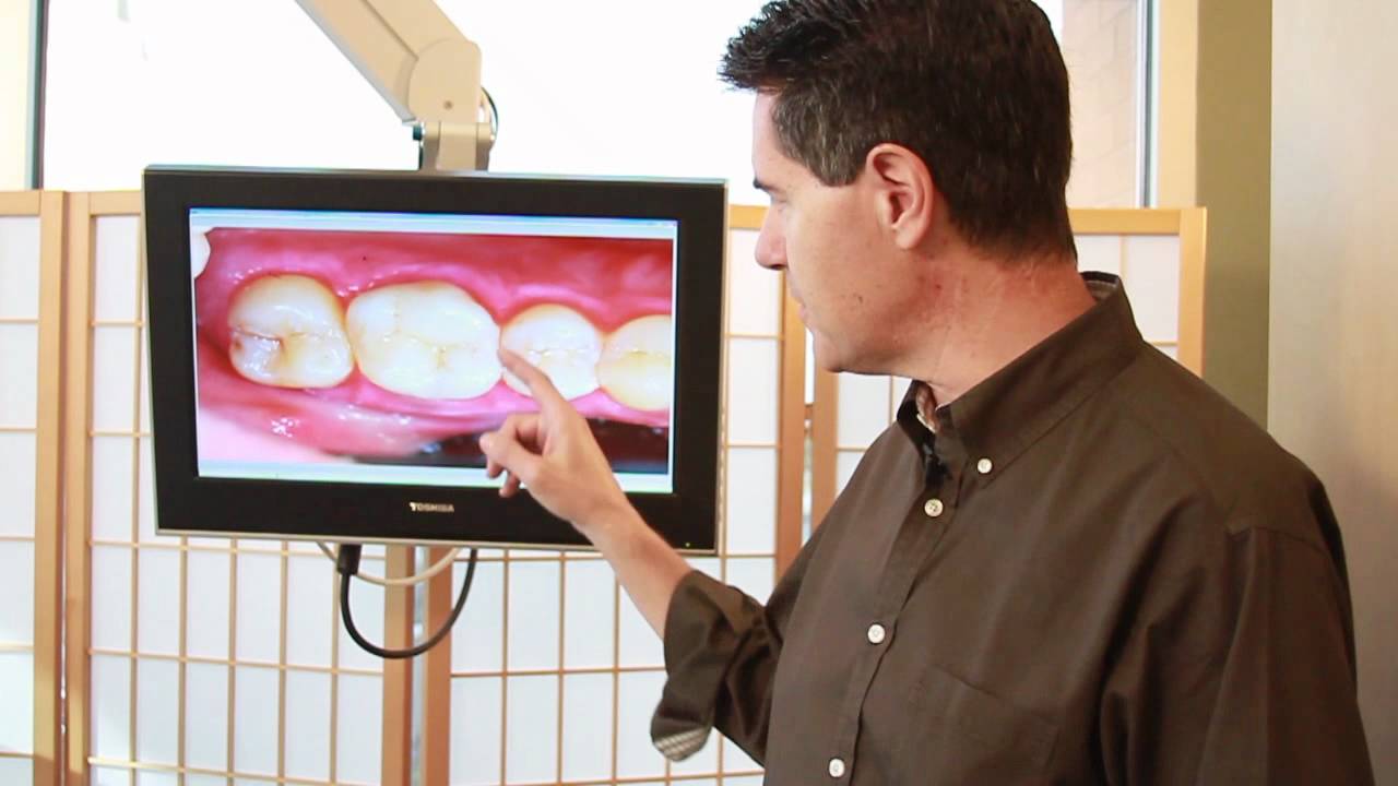 Cerec Dentistry
