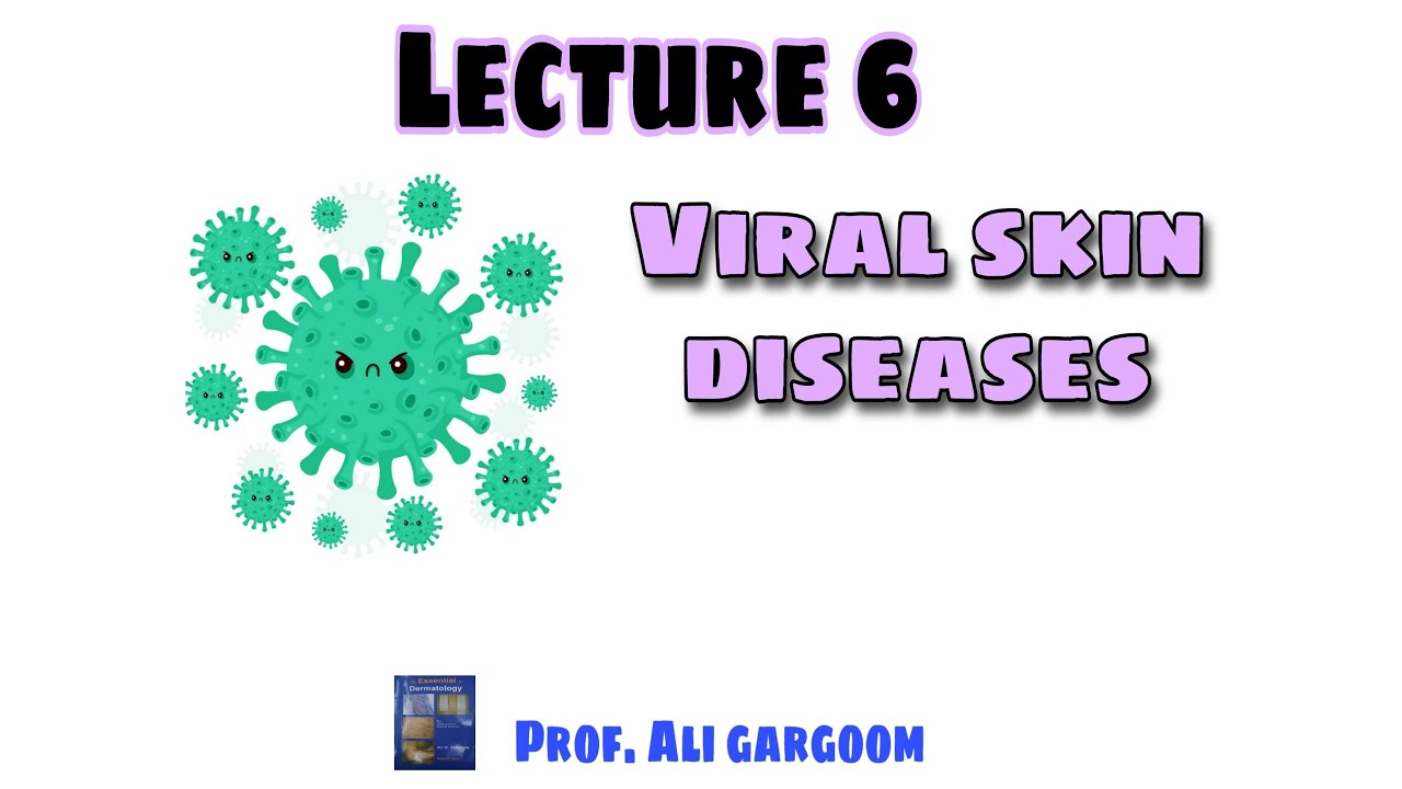 Lecture 6 : Viral Skin Diseases