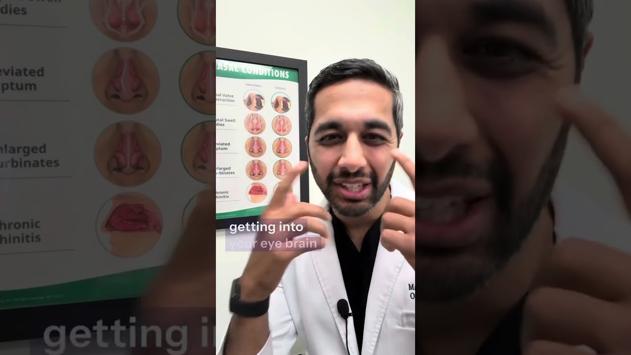 Septoplasty and Turbinate Reduction Information for Patient