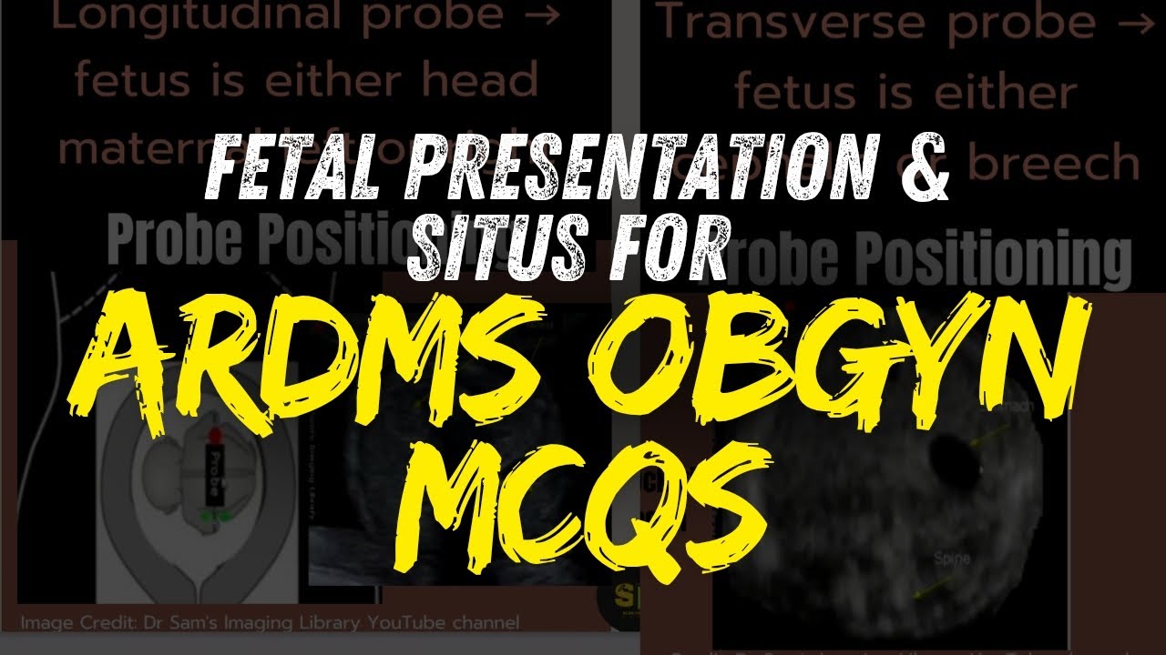 Most ARDMS OB/GYN Sonography Candidates FAIL THIS QUESTION (How to Avoid It)