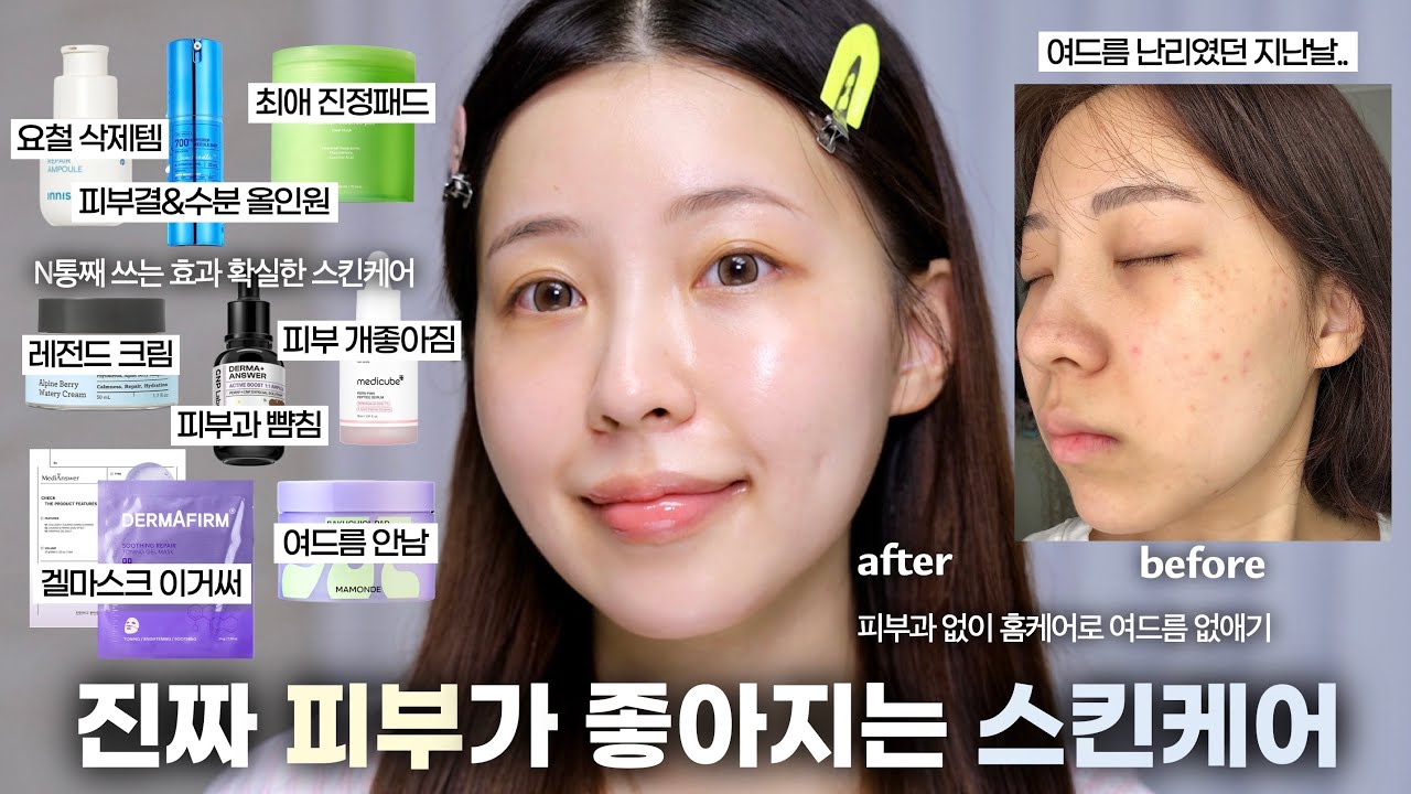 광고❌피부가 무조건 좋아지는 스킨케어 루틴👼🏻(ft.N통째 강력효과 찐템들) / 피부 좋아지는 법 / 여드름 피부 스킨케어 / skincare routine / 윤이든