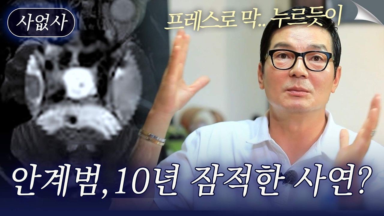 눈이 튀어나오고 어금니가 부러질 정도로.. 톱모델 안계범이 잠적한 사연｜특종세상 사없사 499회