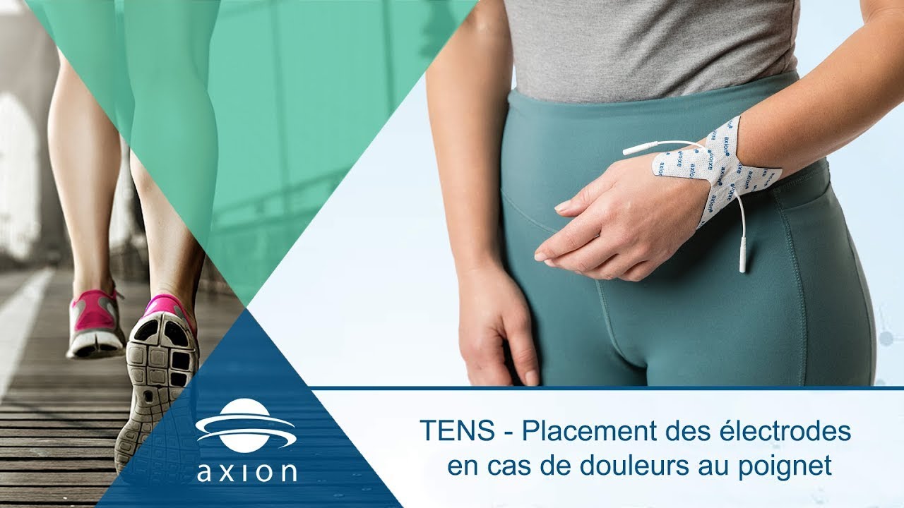 TENS   Placement des &eacute;lectrodes en cas de douleurs au poignet