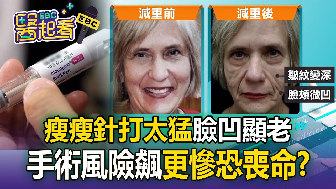 瘦瘦針打太猛「臉凹顯老態」更慘恐喪命？胃部排空變慢「手術風險狂飆」！【東森醫起看】