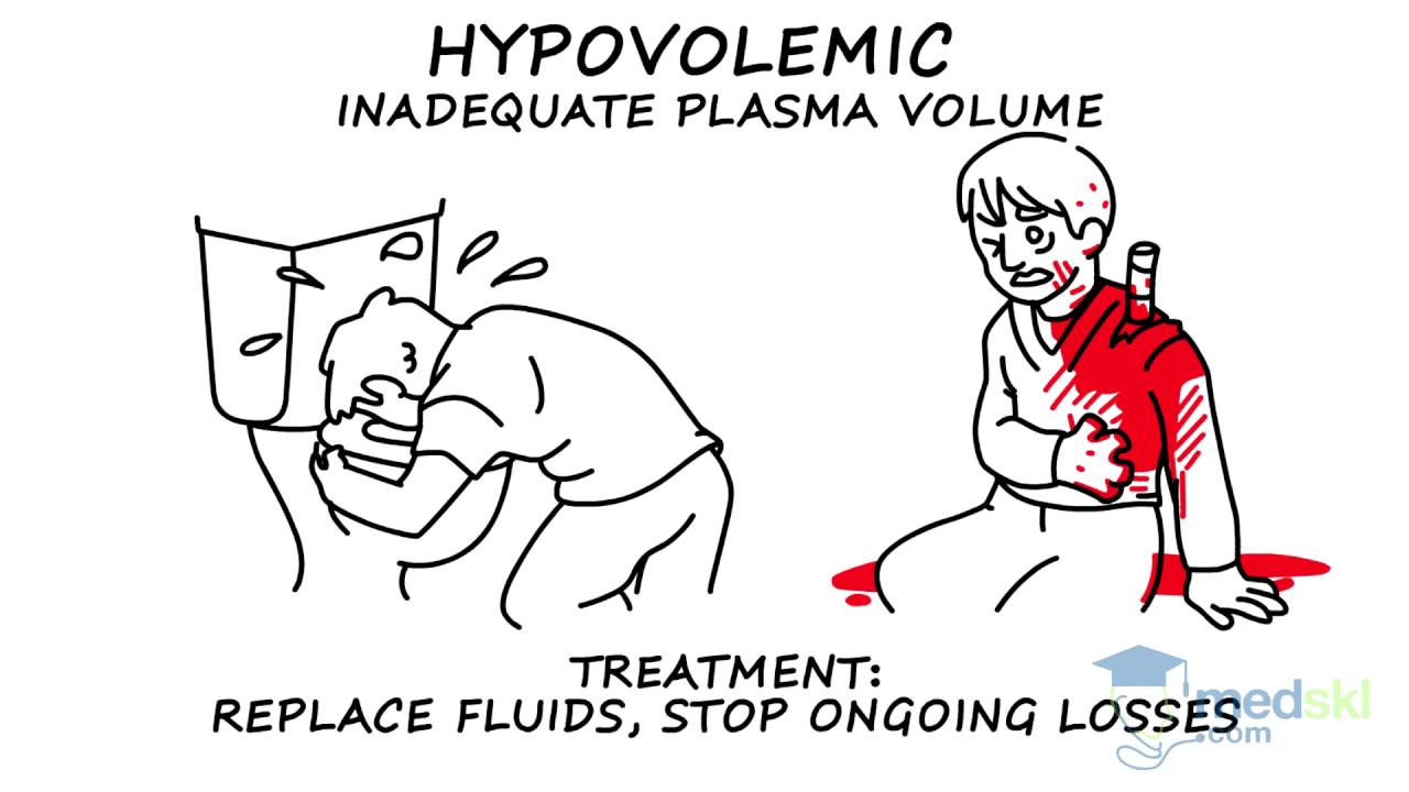 General Surgery - Hypotension and Shock : By Rob Woods M.D.