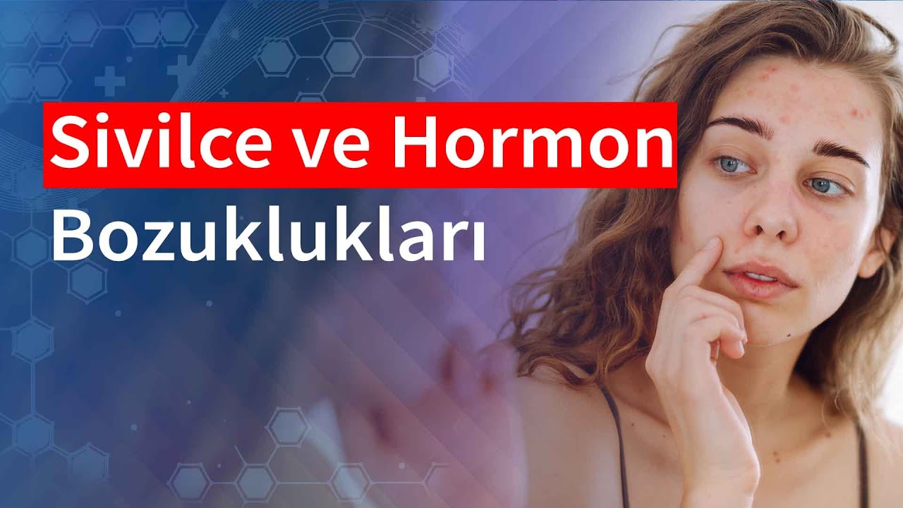 Sivilce ve Hormon Bozuklukları | Medical Park