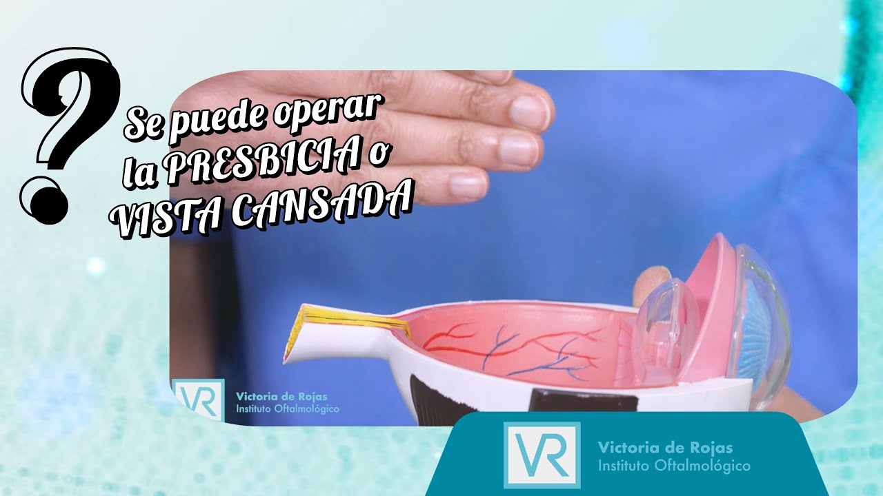 La CIRUGÍA de PRESBICIA o VISTA CANSADA