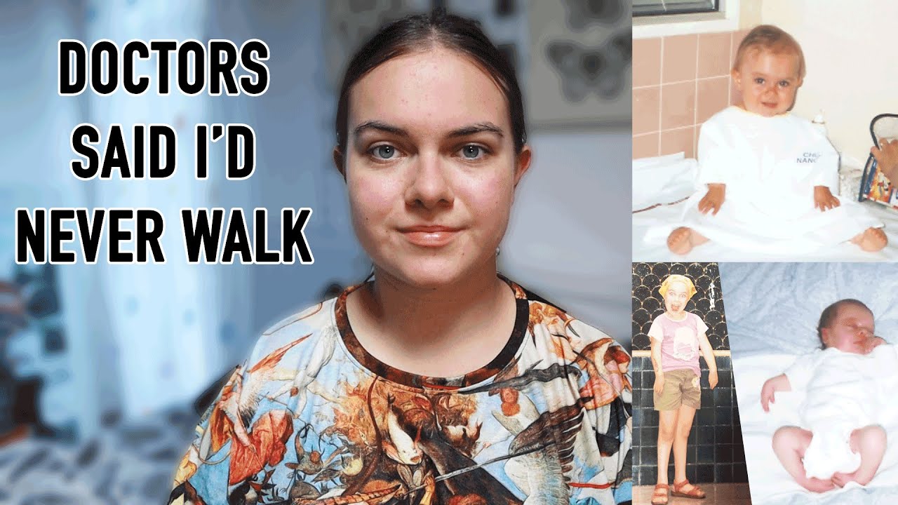 My disability – AMC (arthrogryposis multiplex congenita)