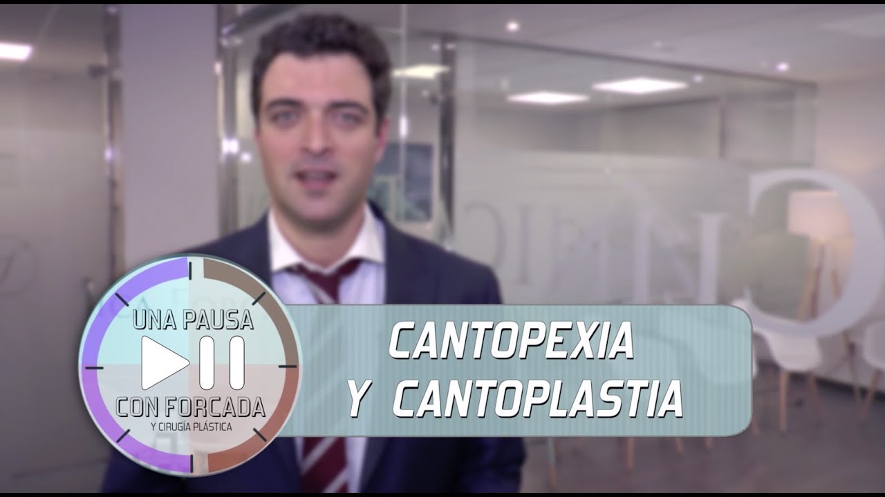 Cantopexia y Cantoplastia