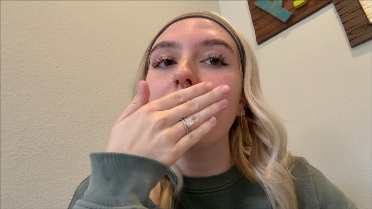 i got lip filler!