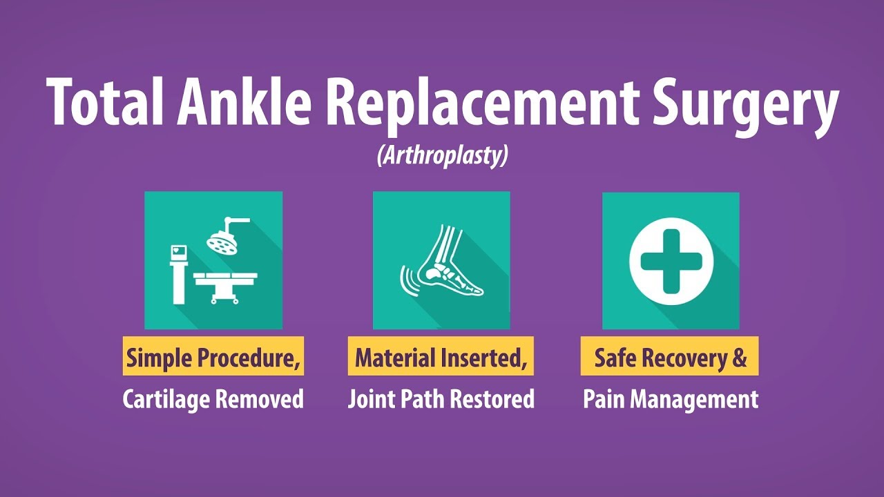 Which is Better: Ankle Replacement or Ankle Fusion?