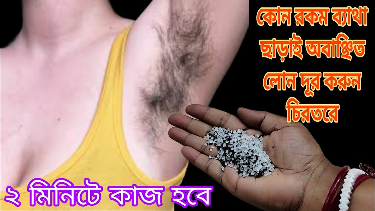 2 মিনিটেই চিরতরে অবাঞ্ছিত লোম দূর করার ঘরোয়া পদ্ধতি 😱 দেখলে আপনিও করবেন / facial hair removal