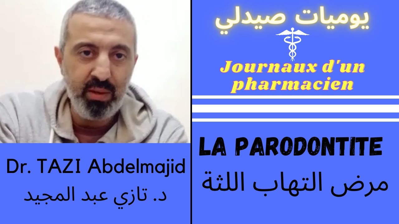 مرض التهاب اللثة : أسبابه، أعراضه و علاجه &bull; La parodontite
