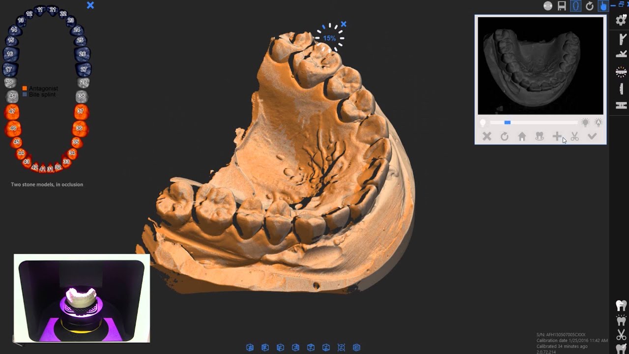 DOF Freedom HD - Dental Scanner (Orthodontic Splint)
