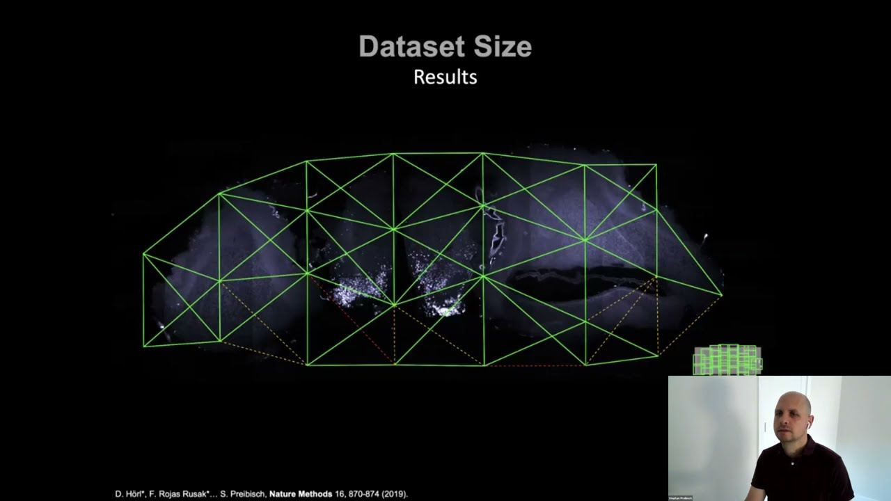 Stephan Preibisch: “Reconstructing large-scale lightsheet microscopy acquisitions”