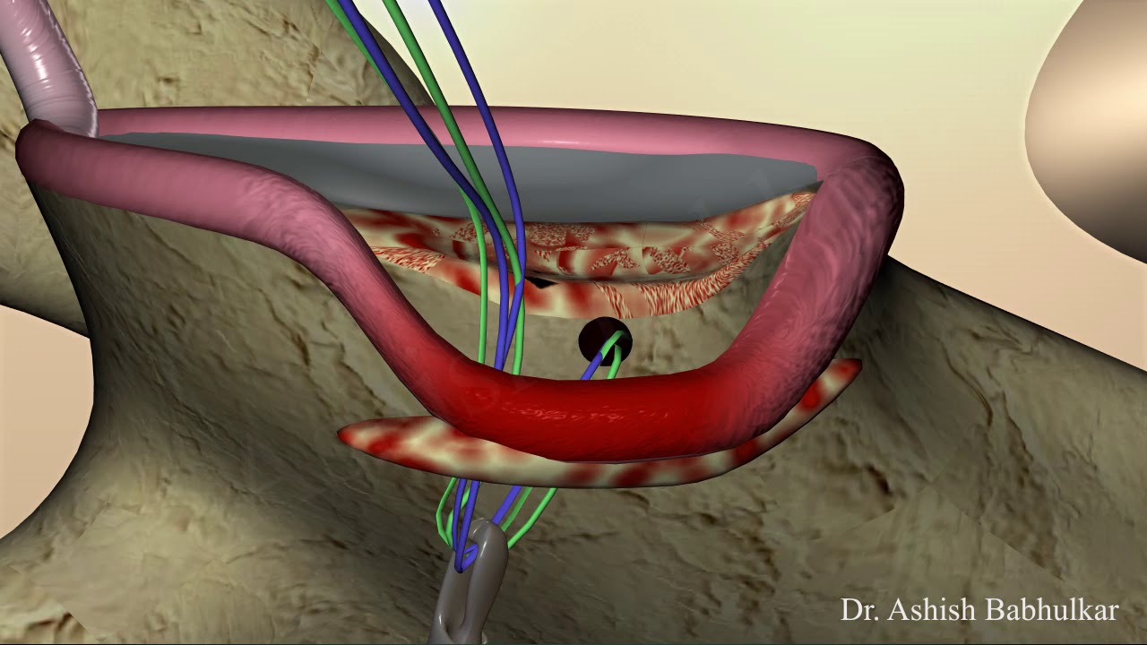 Bony bankart suture bridge mobile