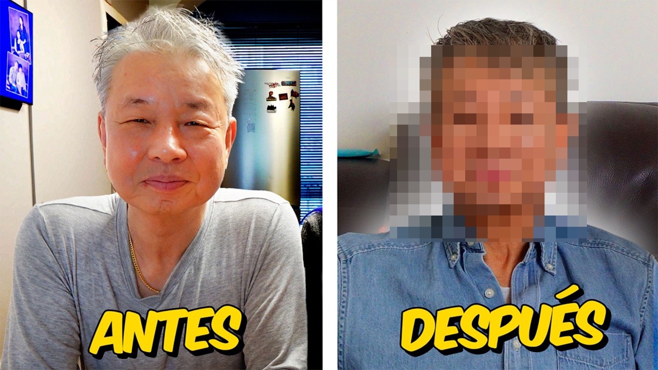 MI PAPÁ SE QUITO 20 AÑOS DE ENCIMA CON CIRUGIA EN COREA !!l Chingu Amiga