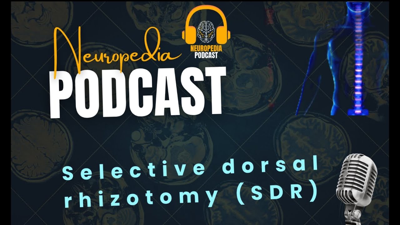 Selective dorsal rhizotomy - جراحة القطع الانتقائي لجذور الاعصاب الفقرية