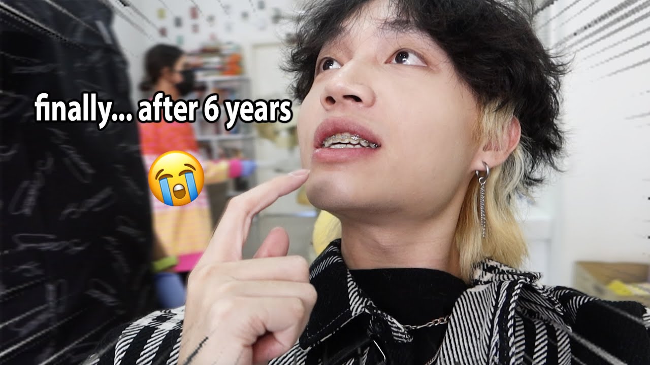 Taking Off My Braces After 6 Years - FINALLY!! (VLOG)