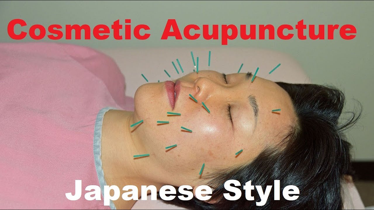 Japanese Style Cosmetic Acupuncture