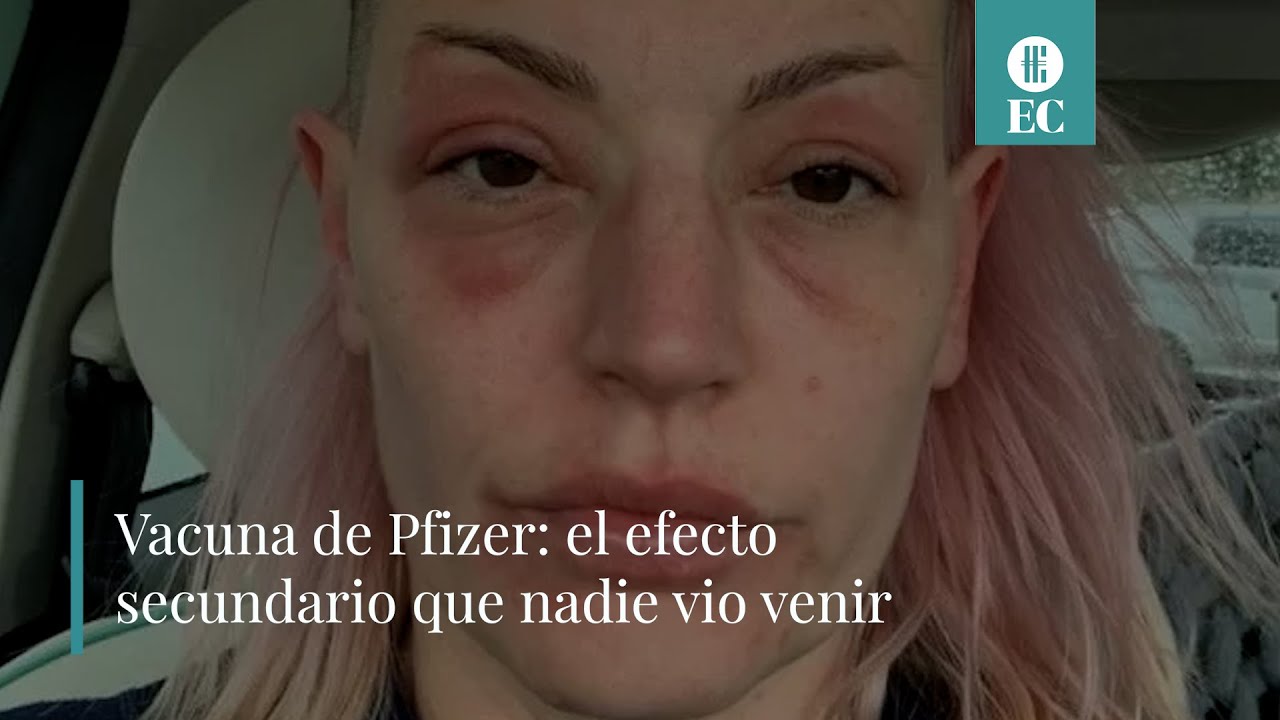 Vacuna PFIZER y COVID-19: los EFECTOS SECUNDARIOS inesperados 🤯 | El Cronista