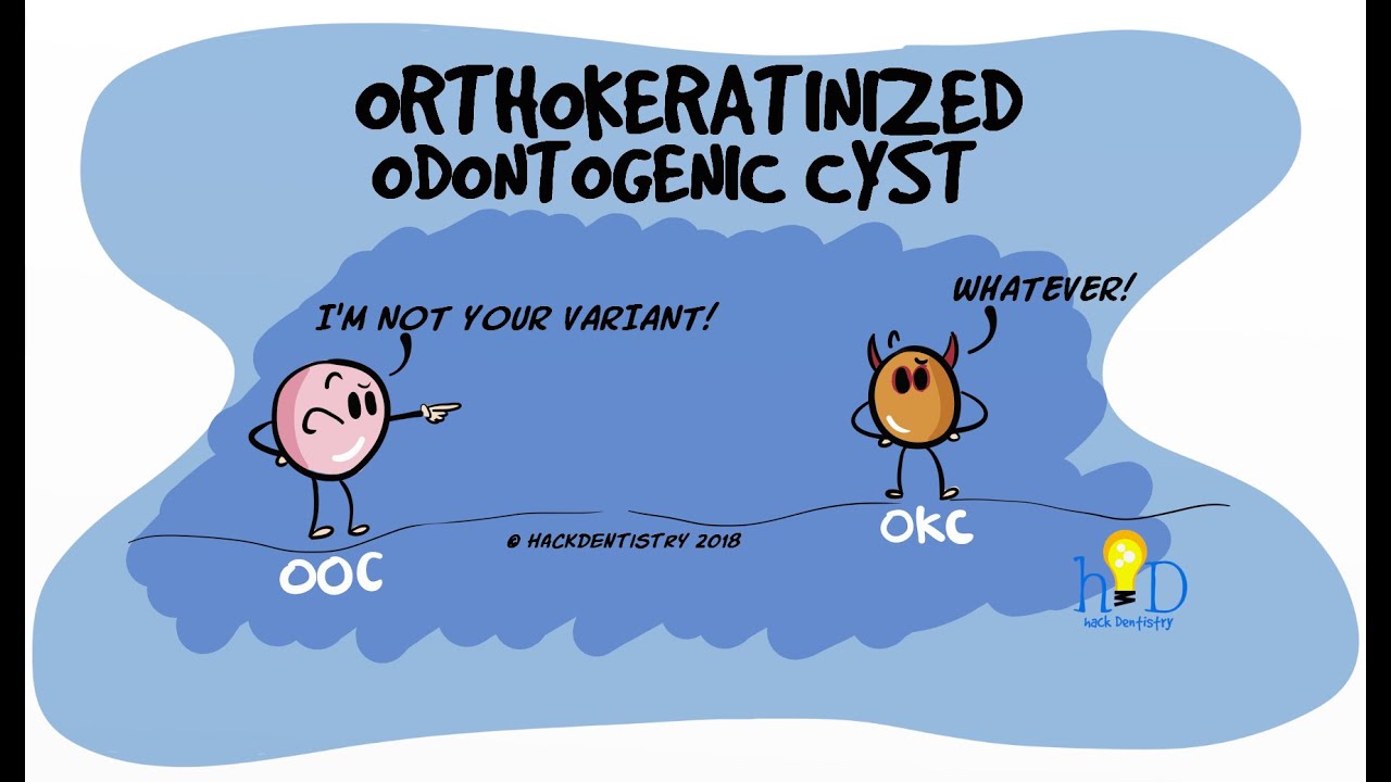 Orthokeratinized Odontogenic Cyst (OOC)