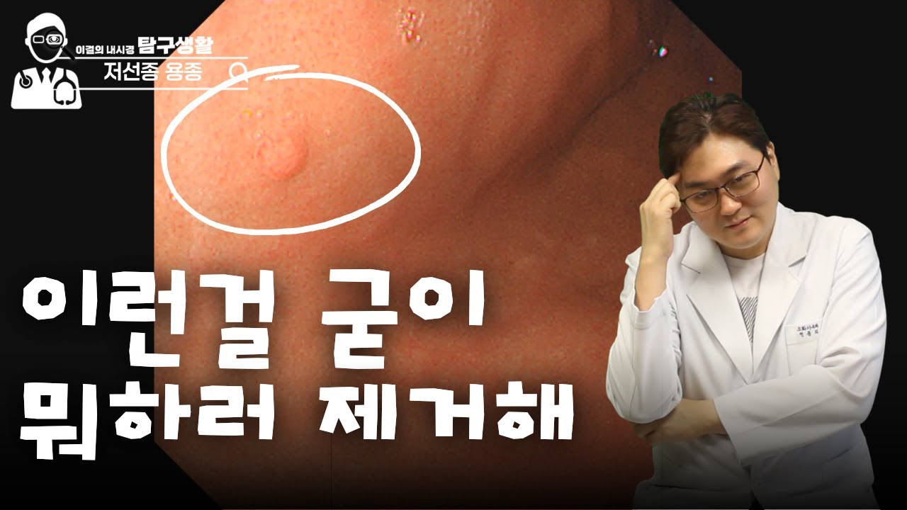 건강검진시 이런 용종은 제거 안 해도 됩니다.