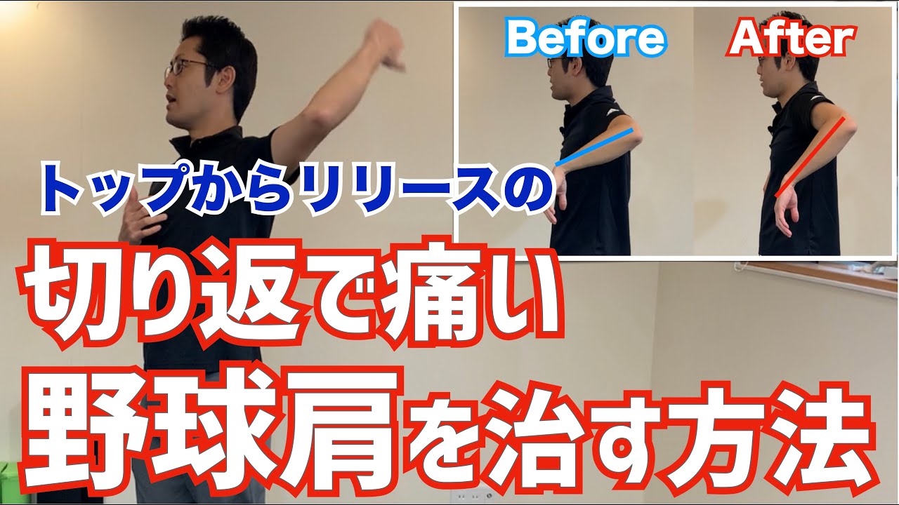 【劇的改善】トップからリリースにかけての肩の痛み、野球肩の治し方　｜京都市北区　MORIピッチングラボ