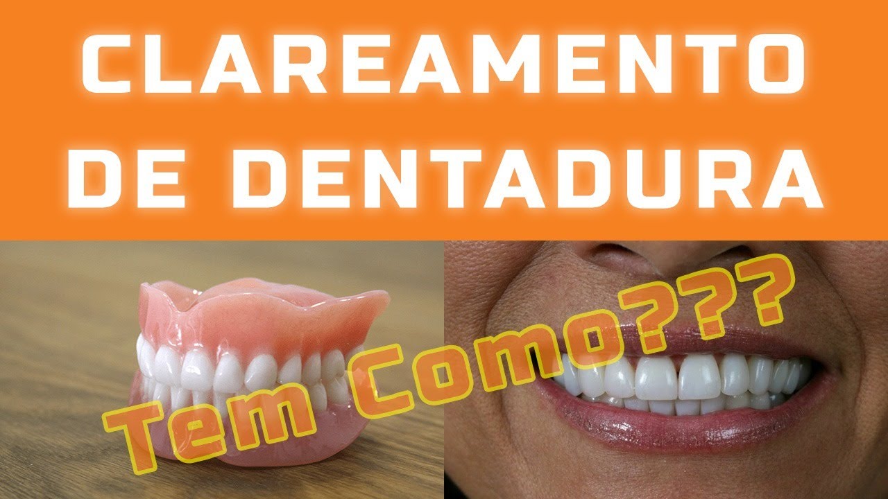 Como clarear minha dentadura? Tem como? &Eacute; poss&iacute;vel?
