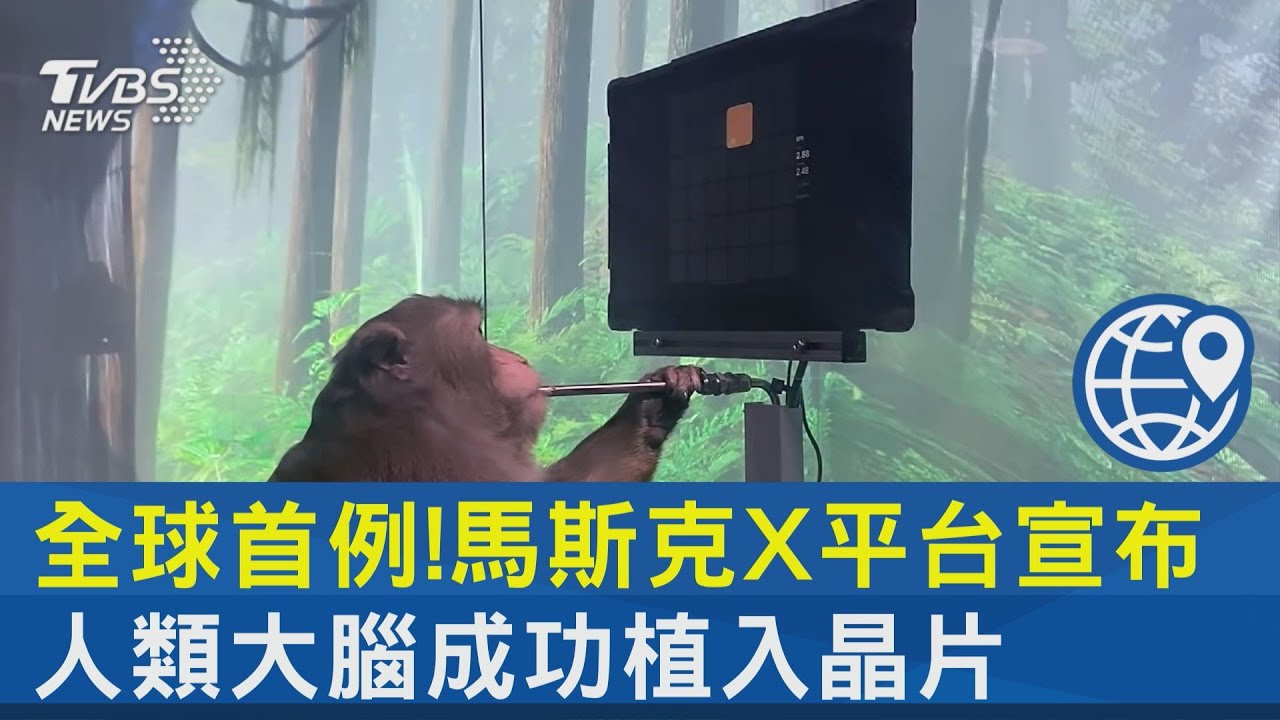 全球首例!馬斯克X平台宣布 人類大腦成功植入晶片｜TVBS新聞 @TVBSNEWS02