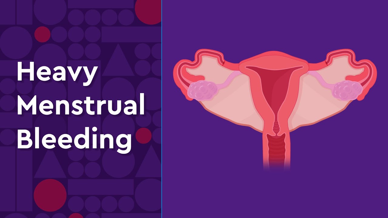 Heavy Menstrual Bleeding and Available Treatment for Teens