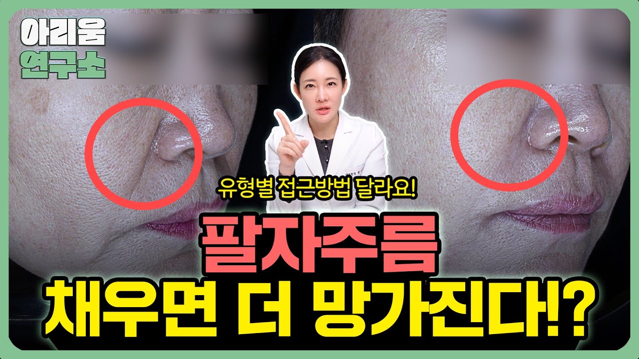 팔자필러 맞기전에 꼭 보세요 ㅣ 유형별 최적 시술 티어리스트 공개