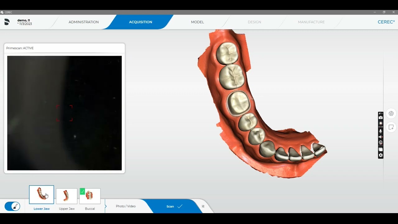 Cerec Software to Connect Software: Workflow Tutorial