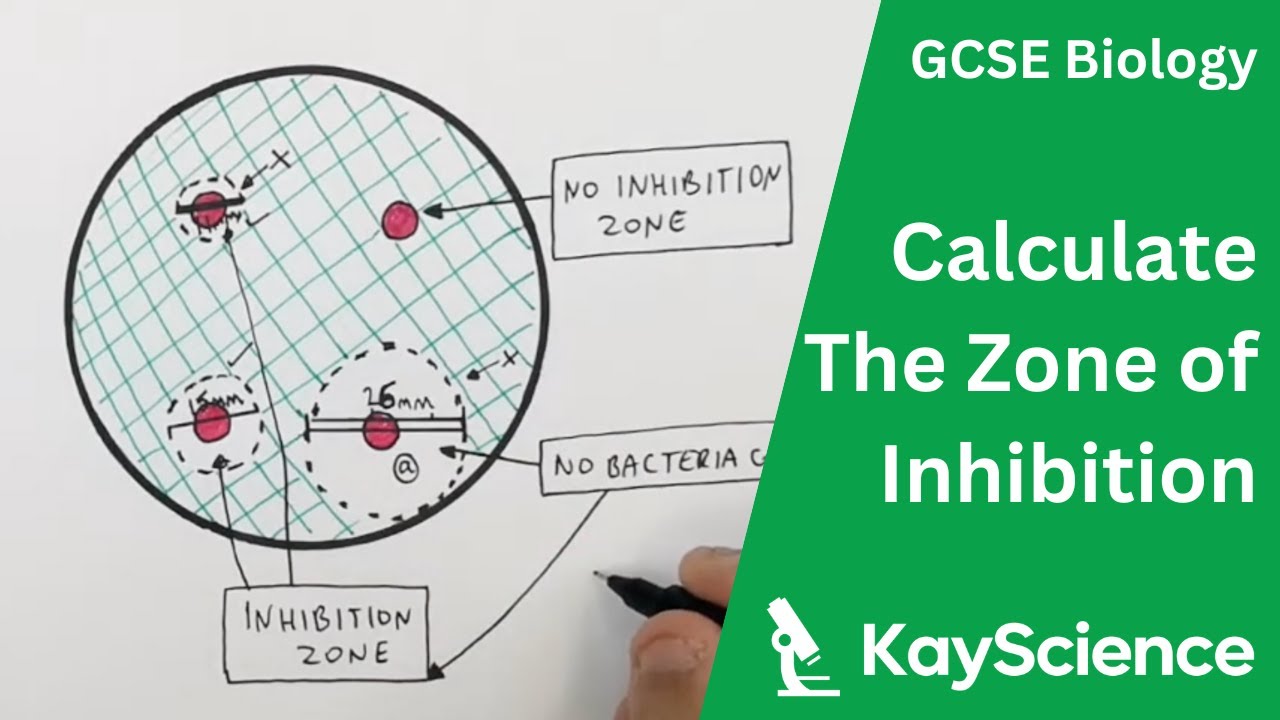 GCSE Biology – Zones of Inhibition in Bacterial Cultures