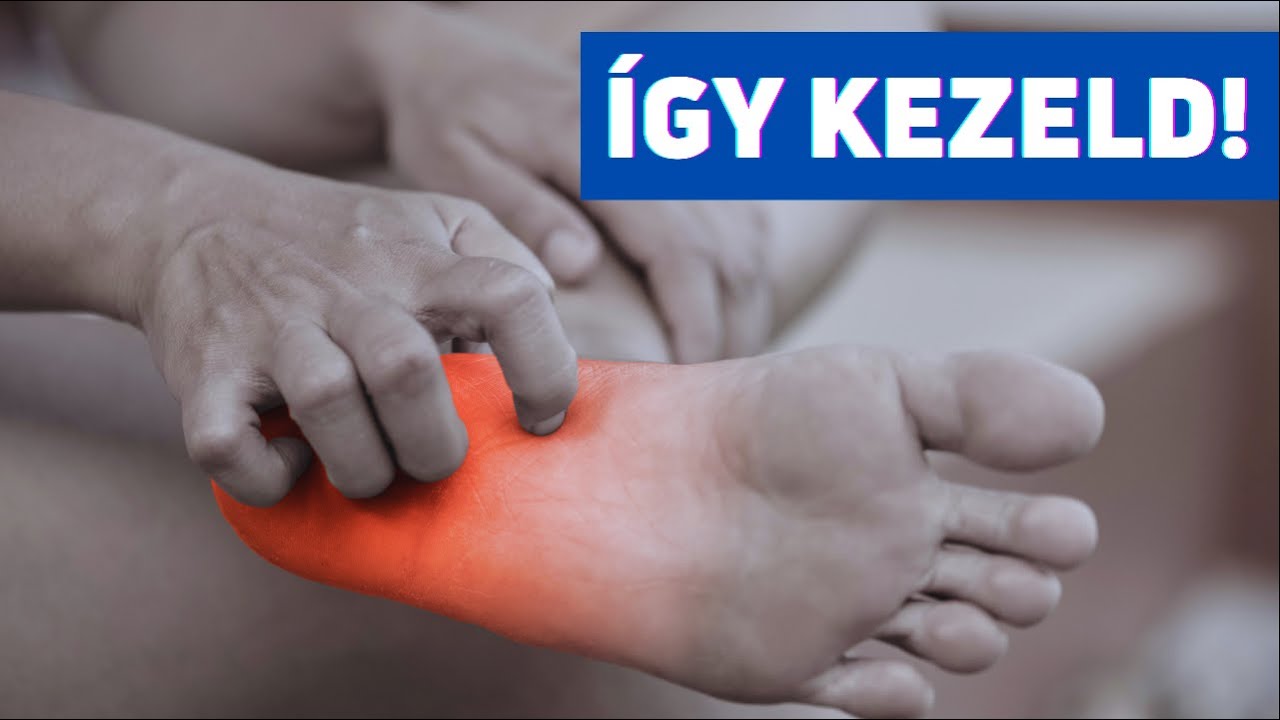 Talpi fascia fájdalom, sarokfájdalom (plantar fasciitis) kezelése
